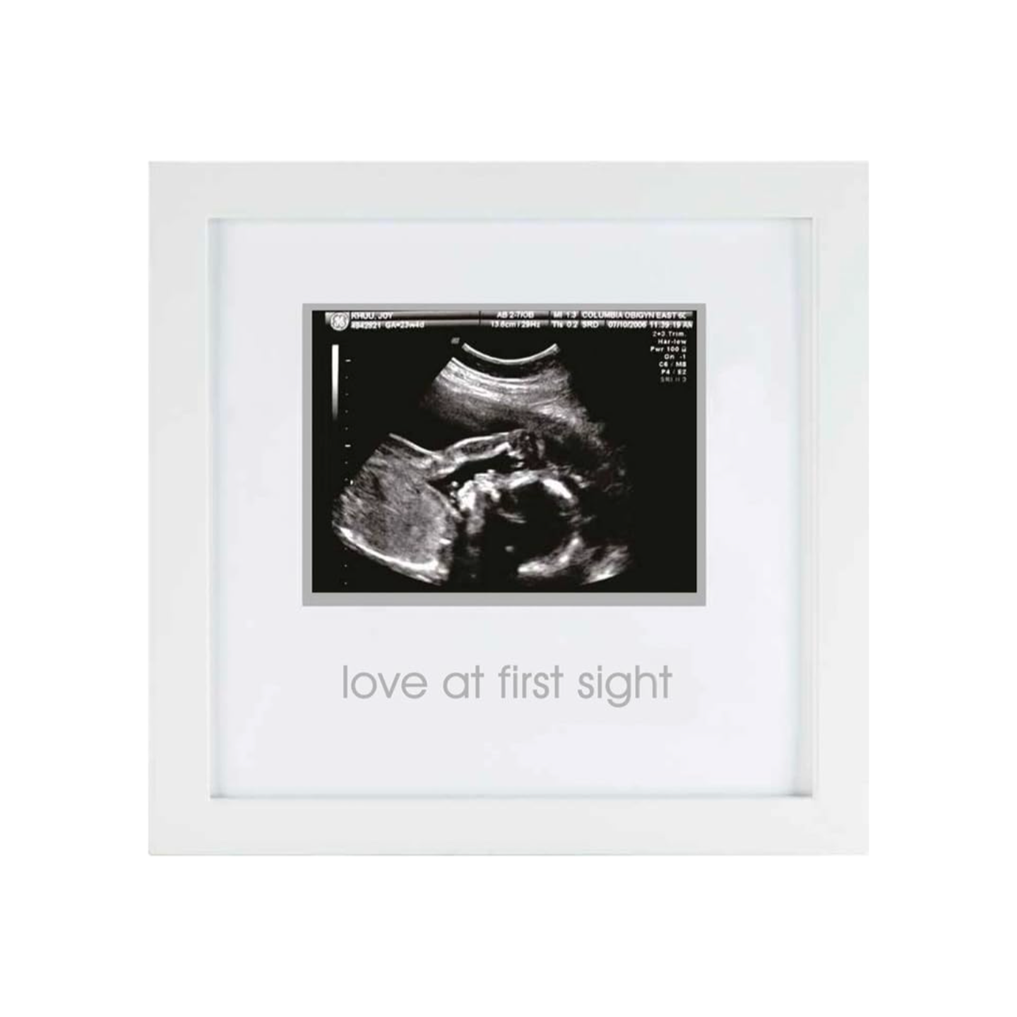 Love at First Sight Frame (White)